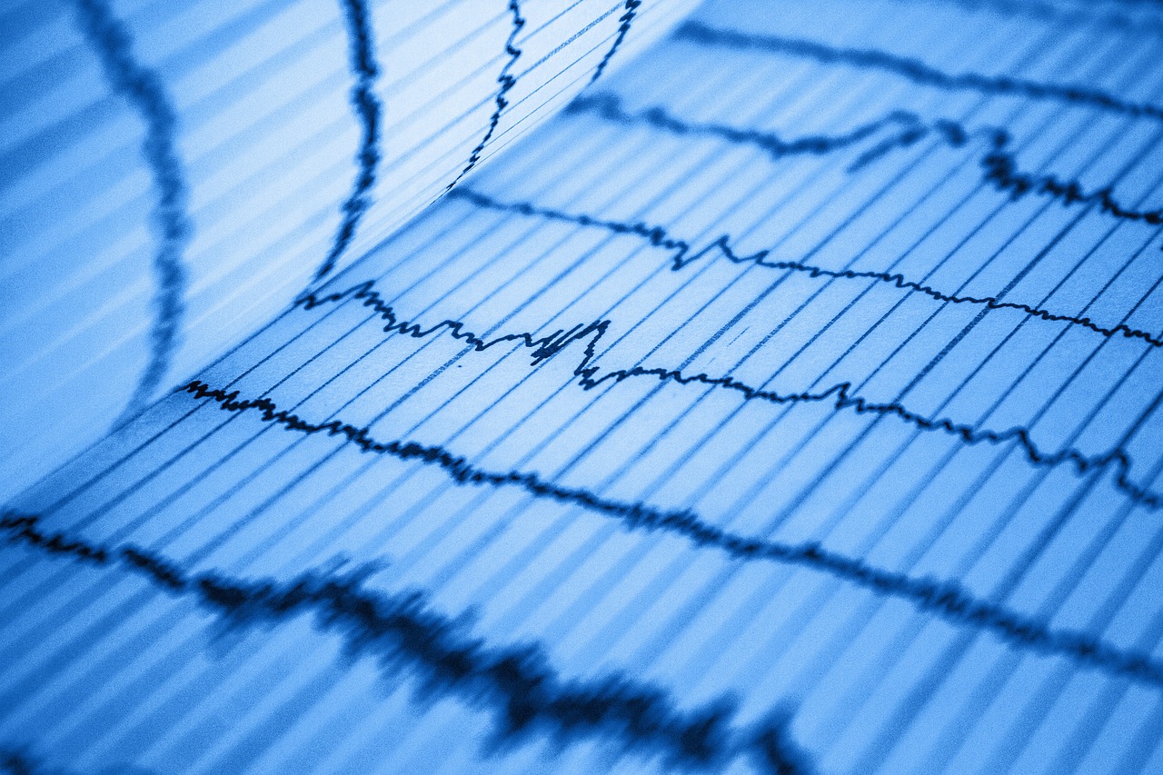 The Role of Chart Patterns in Predicting Market Movements